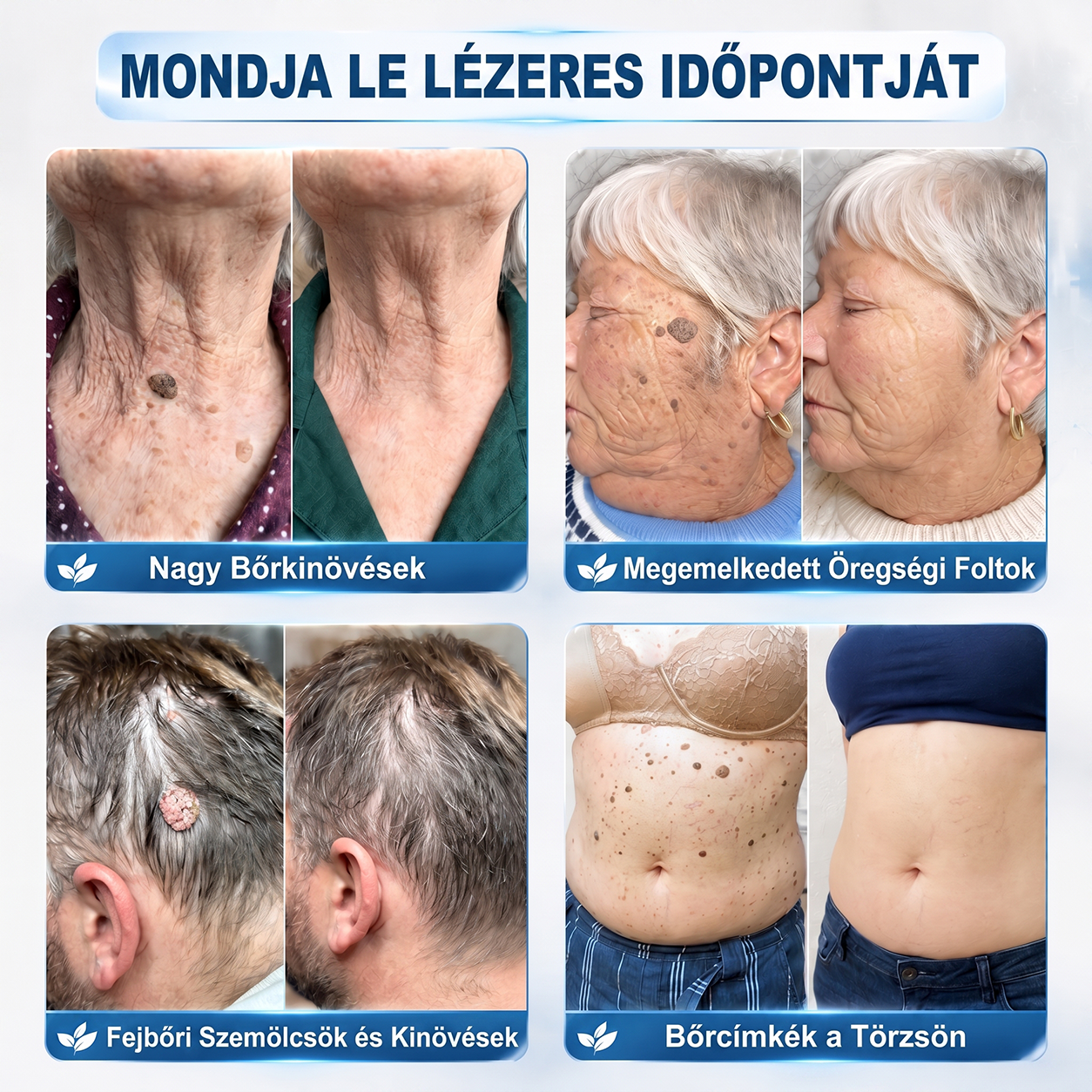 🌿𝐇𝐢𝐒𝐤𝐢𝐧® 🎁 Már csak 5 doboz maradt! A 𝐇𝐢𝐒𝐤𝐢𝐧® 🎁további 30% kedvezményt ad! Állítsd helyre a tested és az egészséged.