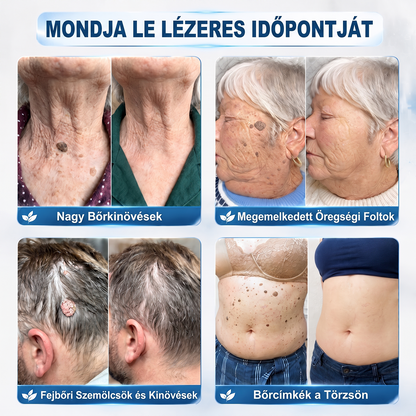🌿𝐇𝐢𝐒𝐤𝐢𝐧® 🎁 Már csak 5 doboz maradt! A 𝐇𝐢𝐒𝐤𝐢𝐧® 🎁további 30% kedvezményt ad! Állítsd helyre a tested és az egészséged.
