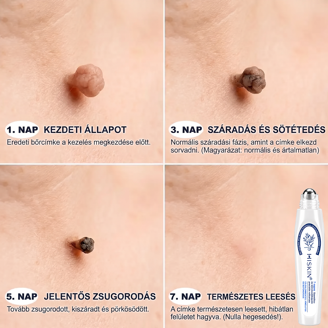 🌿𝐇𝐢𝐒𝐤𝐢𝐧® 🎁 Már csak 5 doboz maradt! A 𝐇𝐢𝐒𝐤𝐢𝐧® 🎁további 30% kedvezményt ad! Állítsd helyre a tested és az egészséged.