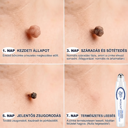 🌿𝐇𝐢𝐒𝐤𝐢𝐧® 🎁 Már csak 5 doboz maradt! A 𝐇𝐢𝐒𝐤𝐢𝐧® 🎁további 30% kedvezményt ad! Állítsd helyre a tested és az egészséged.