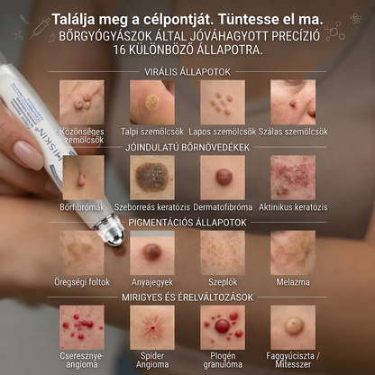 🌿𝐇𝐢𝐒𝐤𝐢𝐧® 🎁 Már csak 5 doboz maradt! A 𝐇𝐢𝐒𝐤𝐢𝐧® 🎁további 30% kedvezményt ad! Állítsd helyre a tested és az egészséged.